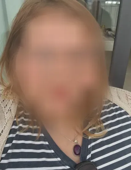 Skye, 23